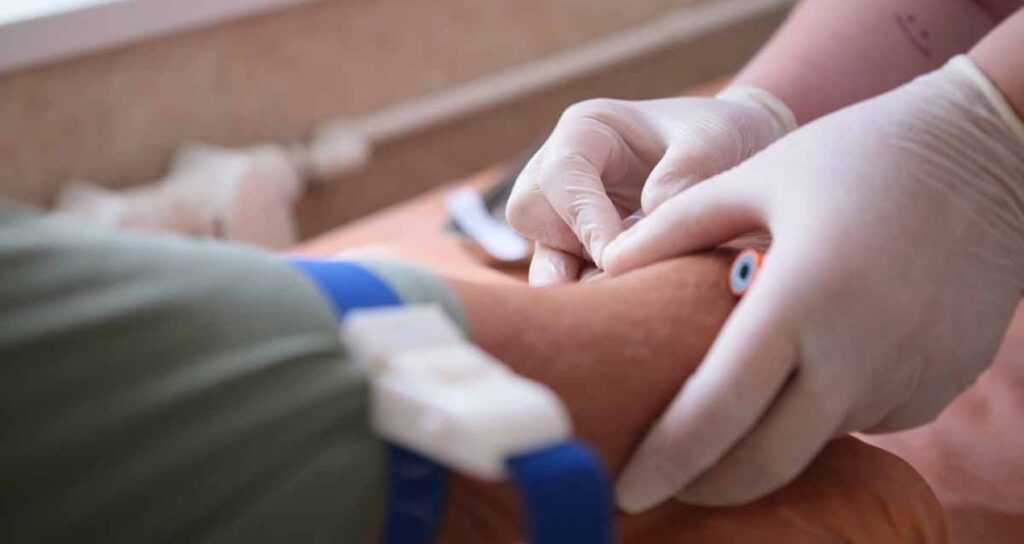 40 yasindan sonra herkesin yaptirmasi gereken 3 kan testi HQ9mbKOK.jpg