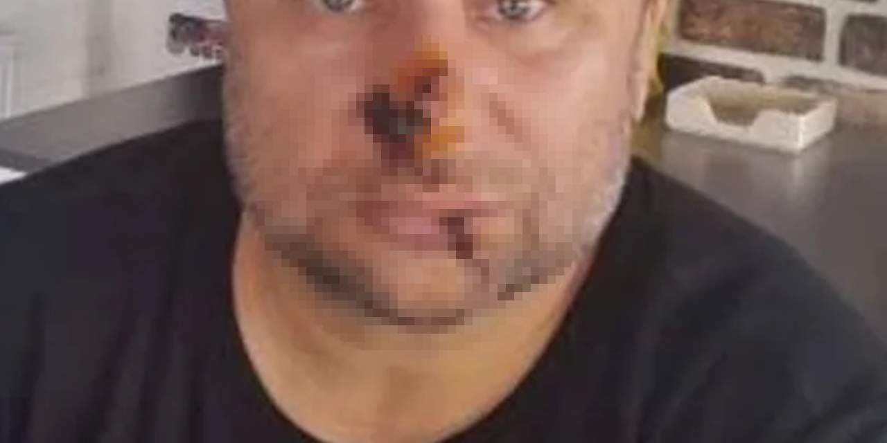 Ünlü Şarkıcı Onur Akay Hayati Tehlike ile Karşı Karşıya: Entübe Edildi